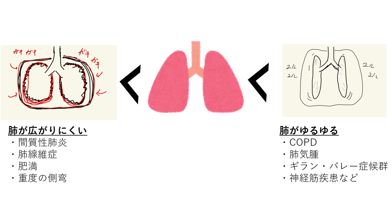 肺が虚脱する原因 _ 肺虚脱 レントゲン : 呼吸と循環の相互作 – TLPYV